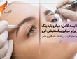 فرق میکروبلیدینگ با میکروپیگمنتیشن ابرو