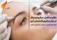 فرق میکروبلیدینگ با میکروپیگمنتیشن ابرو